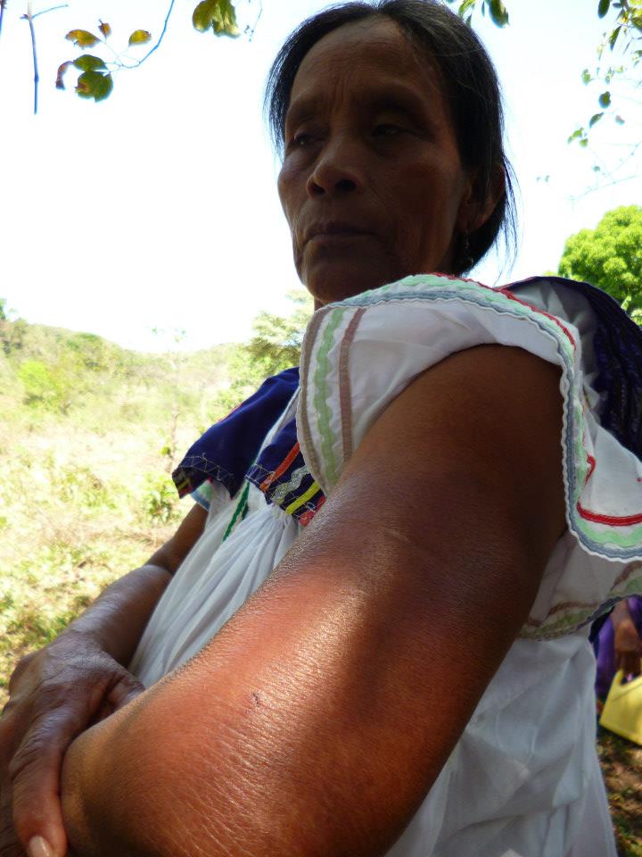 Panama: Police brutality signals impending storm over Barro Blanco hydroelectric project