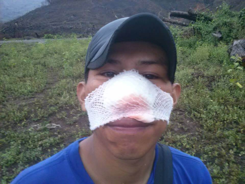 represion8
