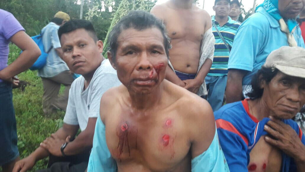 Injuries that appear to have been inflicted by rubber bullets. Credit:  Frenadeso