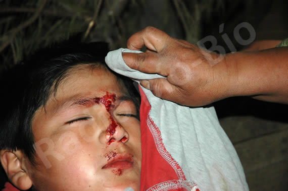 Nino herido